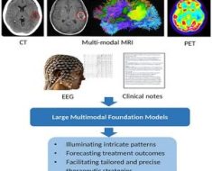 Artificial general intelligence for radiation