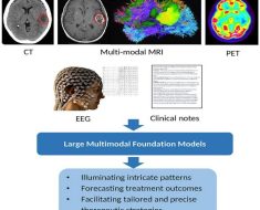 Artificial general intelligence for radiation oncology