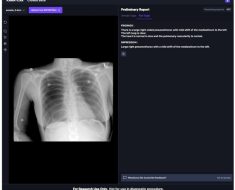 Diagnostics | Free Full-Text | Validation of a Deep Learning Chest X-ray Interpretation Model: Integrating Large-Scale AI and Large Language Models for Comparative Analysis with ChatGPT