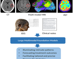 Artificial General Intelligence for Radiation Oncology