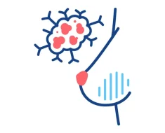 Machine Learning Predicts MS Disease Progression with 11-Protein Panel