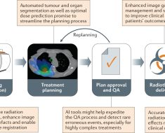 Artificial General Intelligence (AGI) in Radiation Oncology: Transformative Technology