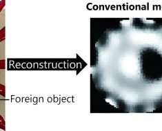 Hybrid machine learning method boosts resolution of electrical impedance tomography