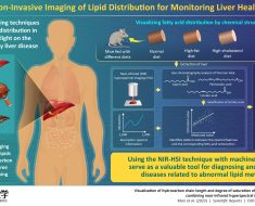 Study unveils machine learning-aided non-invasive imaging for rapid liver fat visualization