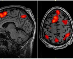 Large Language Models promise to revolutionize neuroscience research