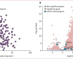 Using machine learning to battle COVID-19 bacterial co-infection